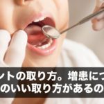 アポイントの取り方。増患につながる効率のいい取り方があるのか？