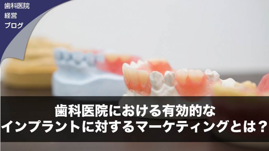 歯科医院における友好的なインプラントに対するマーケティングとは?
